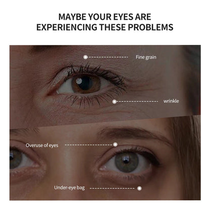 Temporary Eye Tightener