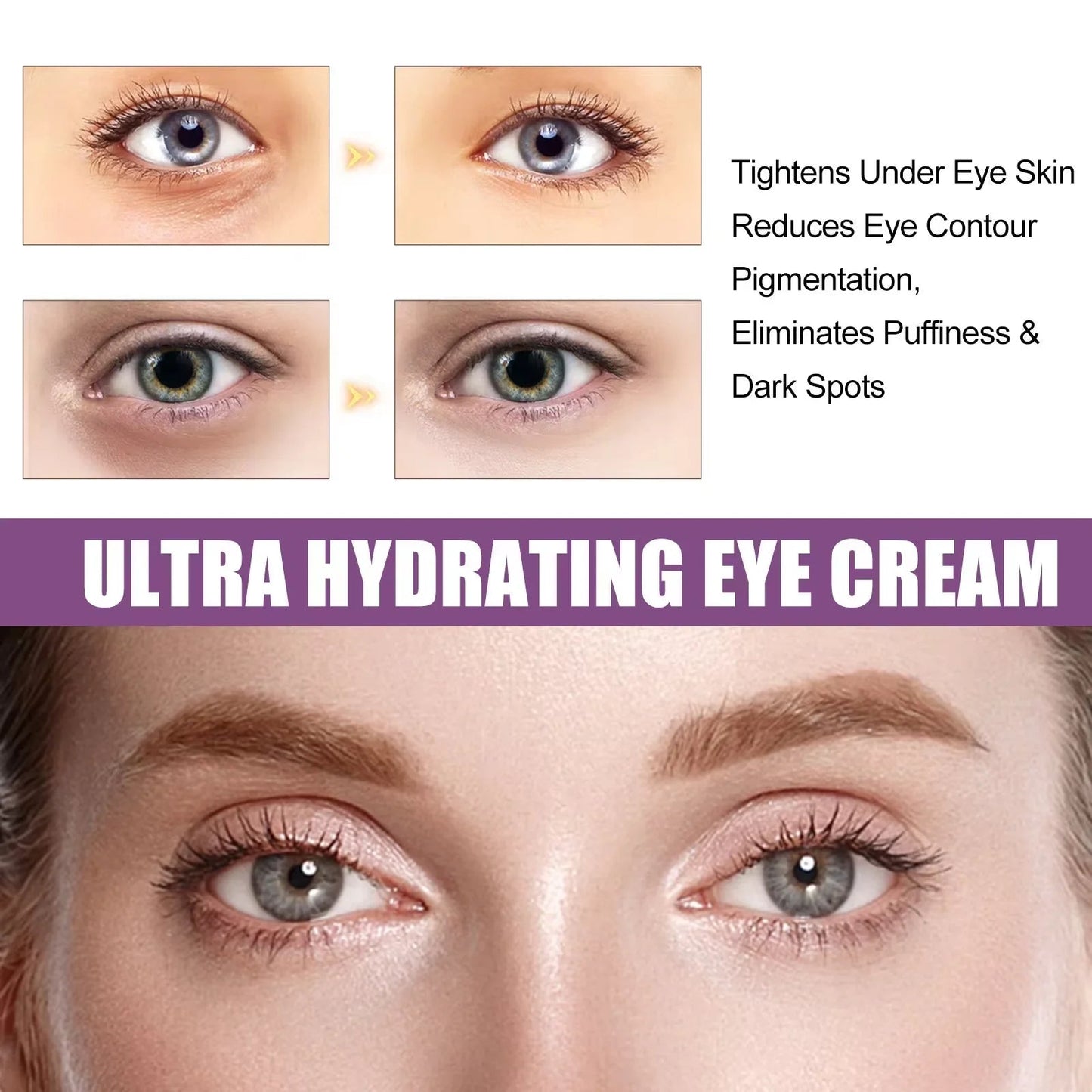 Instant Eye Bag Removal Cream